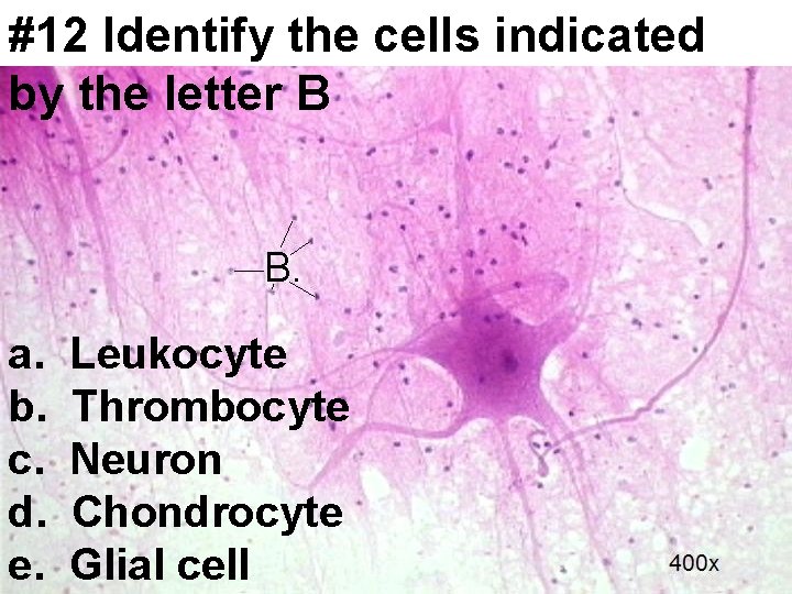 #12 Identify the cells indicated by the letter B a. b. c. d. e.