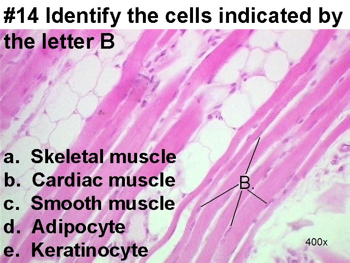 #14 Identify the cells indicated by the letter B a. b. c. d. e.