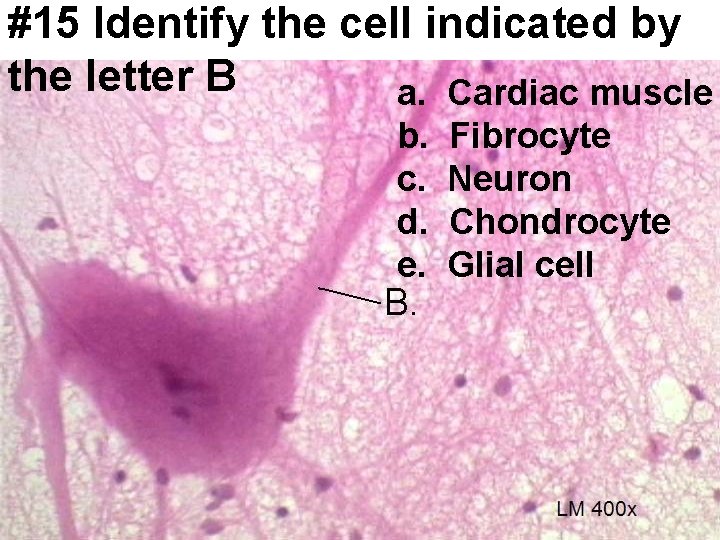 #15 Identify the cell indicated by the letter B a. Cardiac muscle b. c.