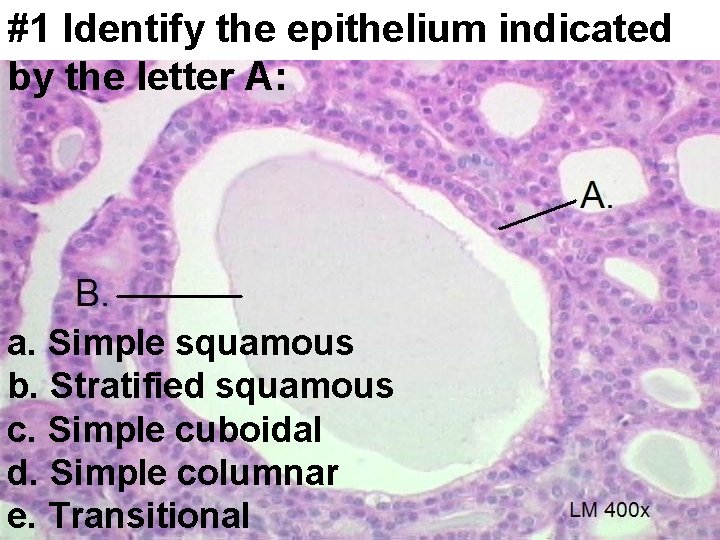 #1 Identify the epithelium indicated by the letter A: a. Simple squamous b. Stratified