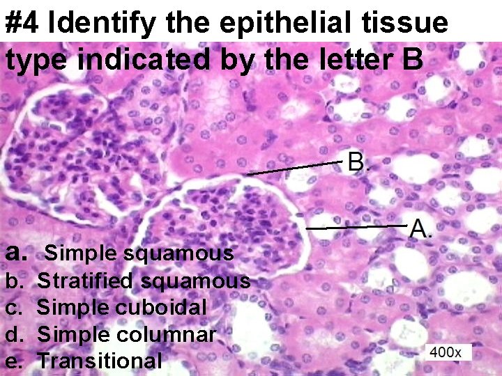 #4 Identify the epithelial tissue type indicated by the letter B a. b. c.