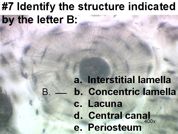 #7 Identify the structure indicated by the letter B: a. b. c. d. e.