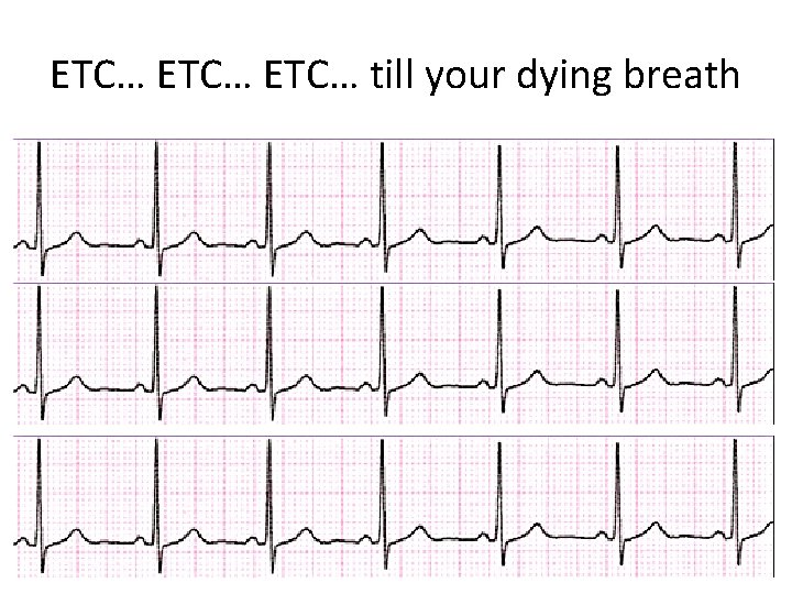 ETC… till your dying breath 