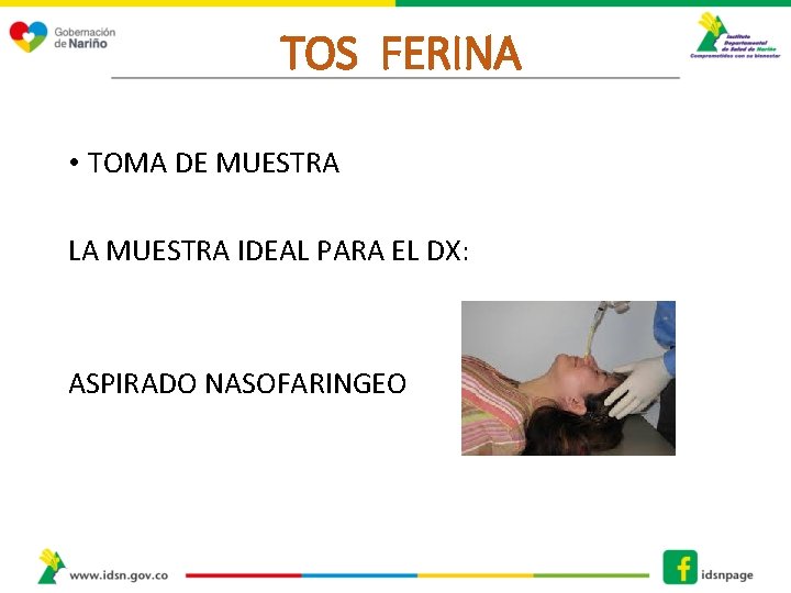 TOS FERINA • TOMA DE MUESTRA LA MUESTRA IDEAL PARA EL DX: ASPIRADO NASOFARINGEO