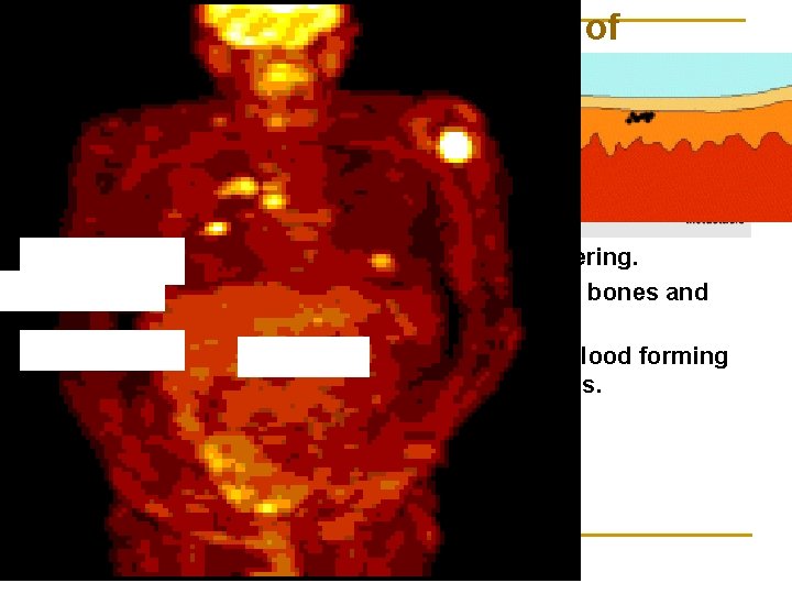 Cancer Cells are Growing out of Control Carcinomas – Cancers of the skin or