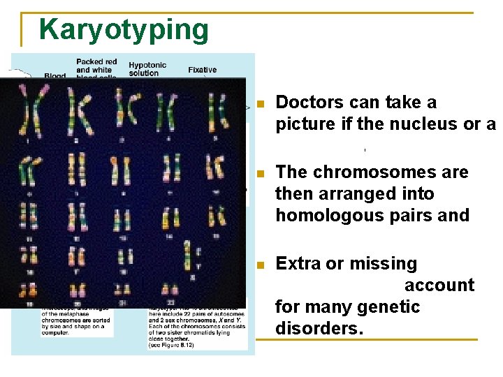 Karyotyping n n n Doctors can take a picture if the nucleus or a
