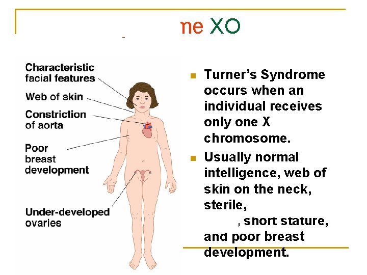 Turner’s Syndrome XO n n Turner’s Syndrome occurs when an individual receives only one