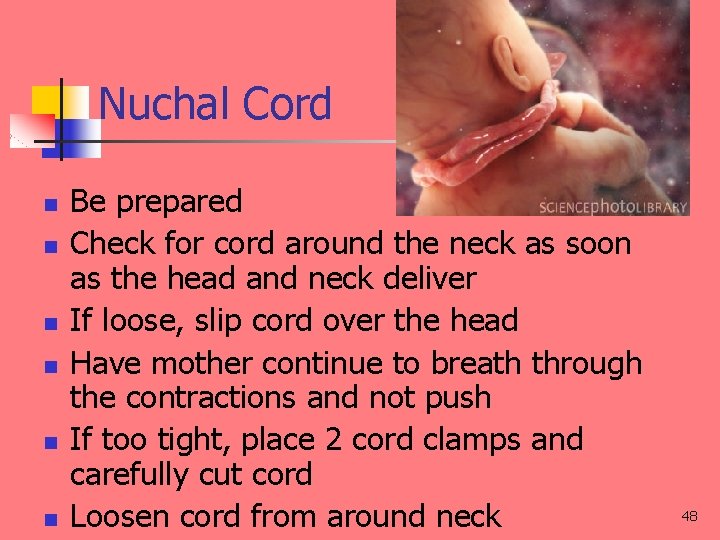 Nuchal Cord n n n Be prepared Check for cord around the neck as