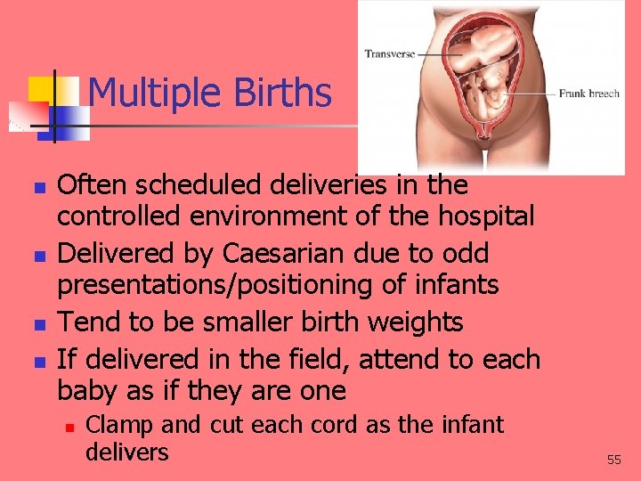 Multiple Births n n Often scheduled deliveries in the controlled environment of the hospital