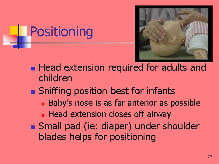 Positioning n n Head extension required for adults and children Sniffing position best for