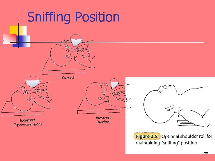 Sniffing Position 78 