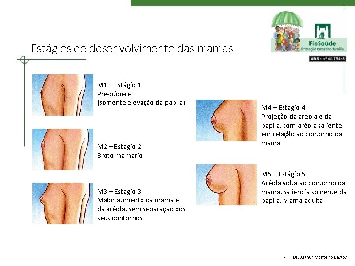 Estágios de desenvolvimento das mamas M 1 – Estágio 1 Pré-púbere (somente elevação da