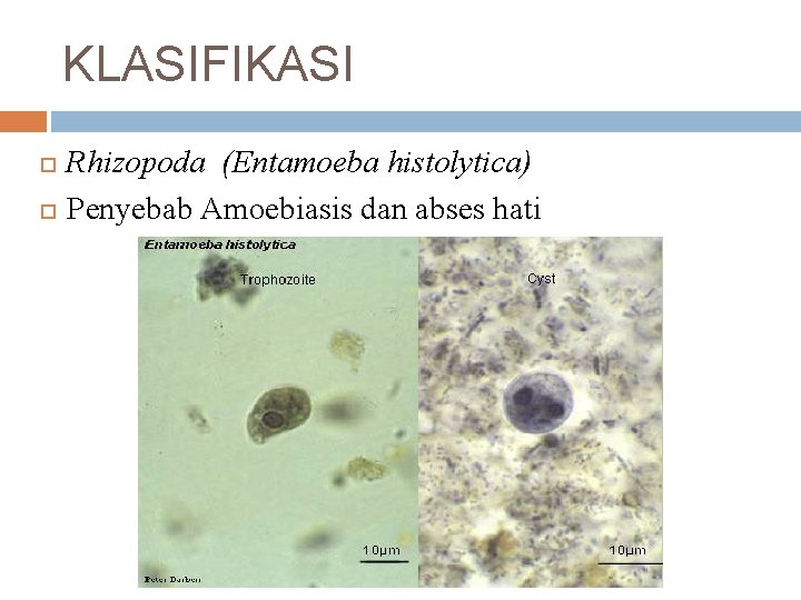 KLASIFIKASI Rhizopoda (Entamoeba histolytica) Penyebab Amoebiasis dan abses hati 