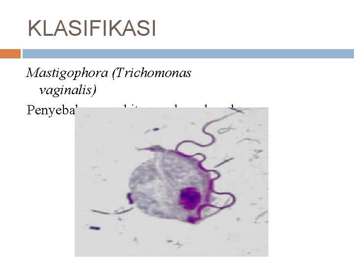 KLASIFIKASI Mastigophora (Trichomonas vaginalis) Penyebab penyakit menular seksual 