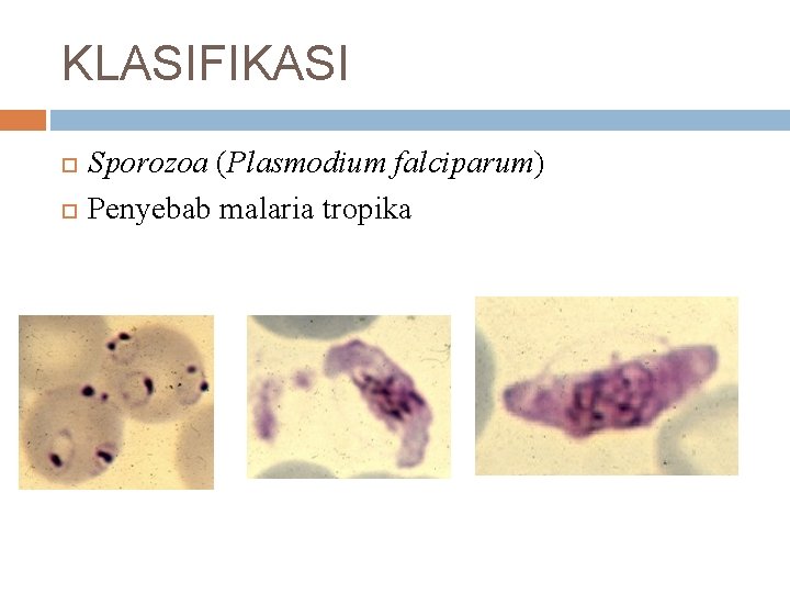 KLASIFIKASI Sporozoa (Plasmodium falciparum) Penyebab malaria tropika 