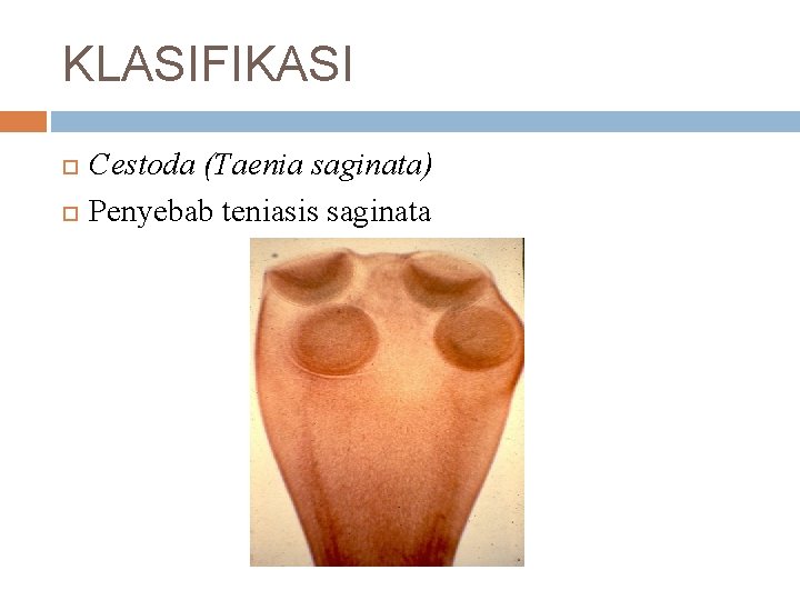 KLASIFIKASI Cestoda (Taenia saginata) Penyebab teniasis saginata 