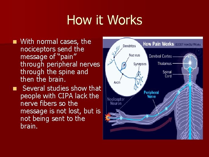 How it Works With normal cases, the nociceptors send the message of “pain” through