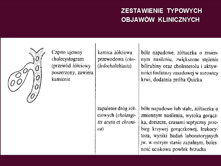 ZESTAWIENIE TYPOWYCH OBJAWÓW KLINICZNYCH 