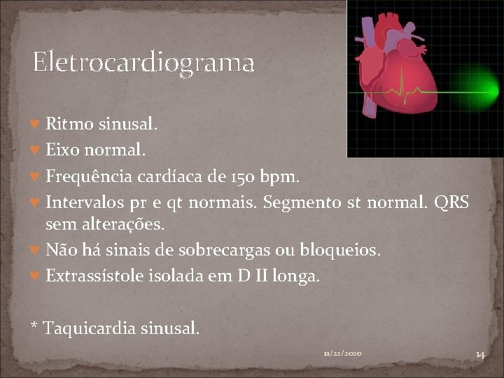 Eletrocardiograma ♥ Ritmo sinusal. ♥ Eixo normal. ♥ Frequência cardíaca de 150 bpm. ♥