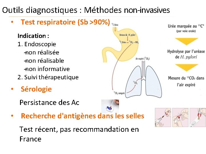 Outils diagnostiques : Méthodes non‐invasives • Test respiratoire (Sb >90%) Indication : 1. Endoscopie