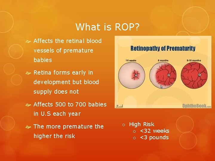 What is ROP? Affects the retinal blood vessels of premature babies Retina forms early