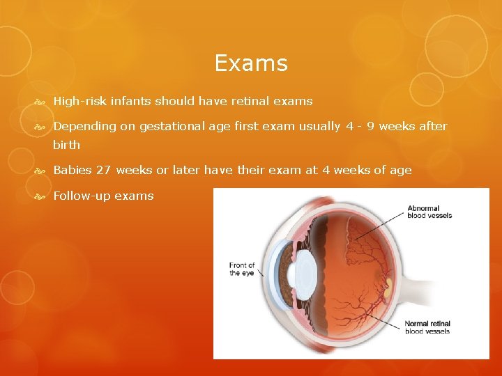 Exams High-risk infants should have retinal exams Depending on gestational age first exam usually