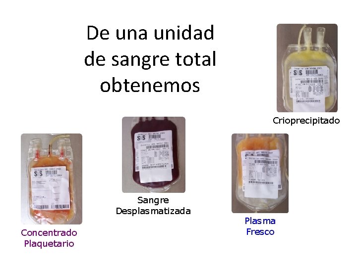 De una unidad de sangre total obtenemos Crioprecipitado Sangre Desplasmatizada Concentrado Plaquetario Plasma Fresco