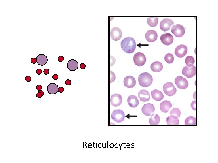 Reticulocytes 