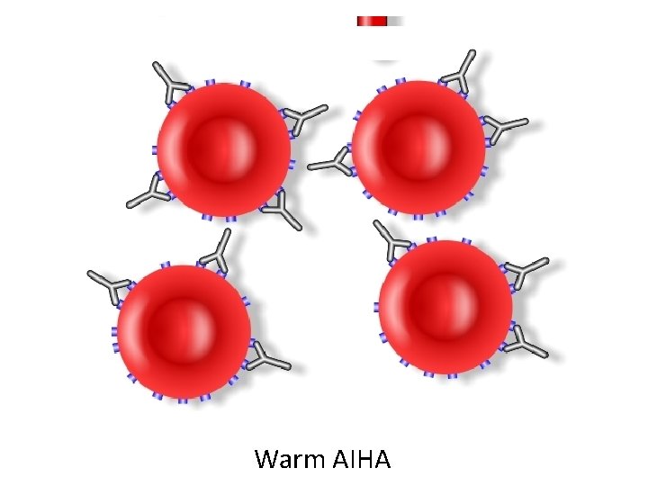 Warm AIHA 