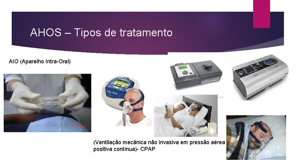 AHOS – Tipos de tratamento AIO (Aparelho Intra-Oral) (Ventilação mecânica não invasiva em pressão