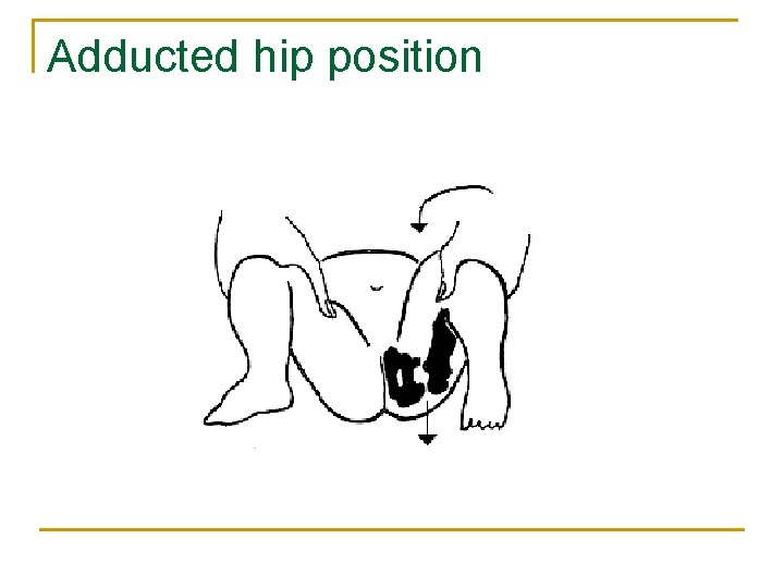 Adducted hip position 