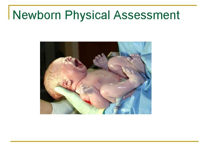 Newborn Physical Assessment 