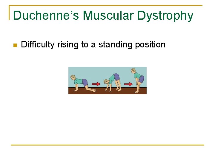 Duchenne’s Muscular Dystrophy n Difficulty rising to a standing position 
