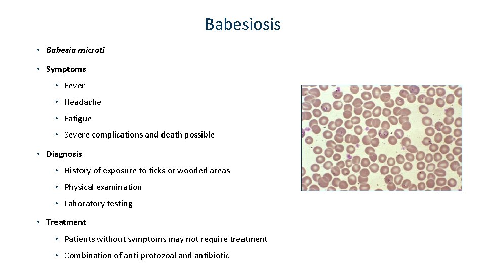 Babesiosis • Babesia microti • Symptoms • Fever • Headache • Fatigue • Severe