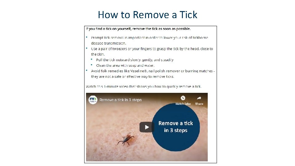 How to Remove a Tick 