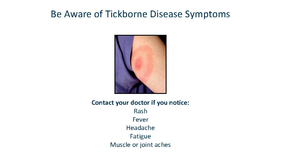 Be Aware of Tickborne Disease Symptoms Contact your doctor if you notice: Rash Fever