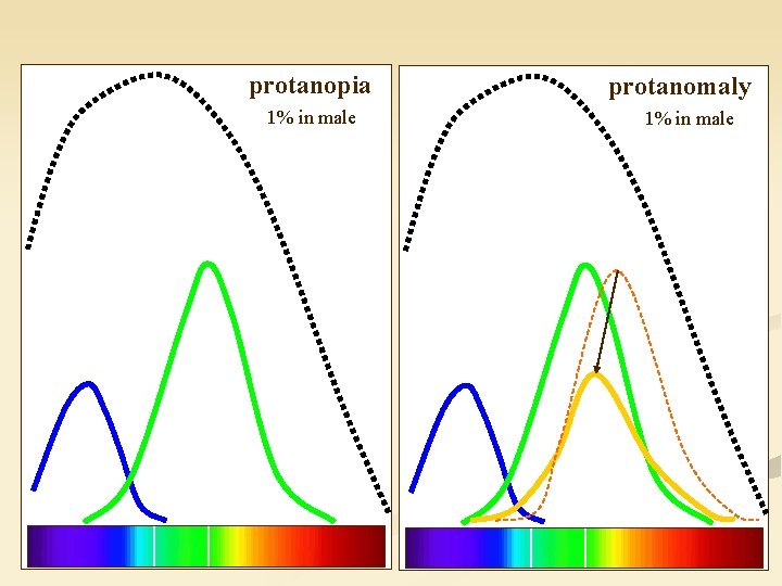 protanopia 1% in male protanomaly 1% in male 