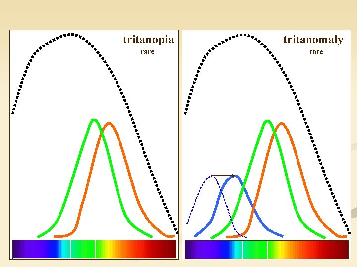 tritanopia rare tritanomaly rare 