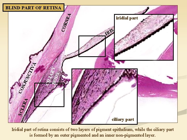 CO RN EA BLIND PART OF RETINA iridial part S I IR CIL IA