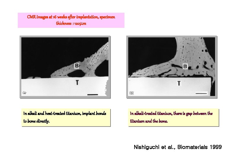 CMR images at 16 weeks after implantation, specimen thickness : 120 m In alkali