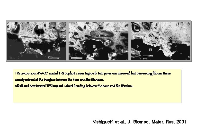 TPS control and AW-GC coated TPS implant : bone ingrowth into pores was observed,