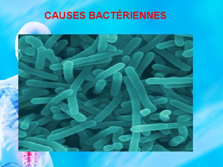 CAUSES BACTÉRIENNES 