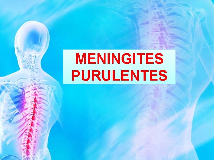 MENINGITES PURULENTES 