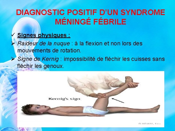 DIAGNOSTIC POSITIF D’UN SYNDROME MÉNINGÉ FÉBRILE ü Signes physiques : Ø Raideur de la