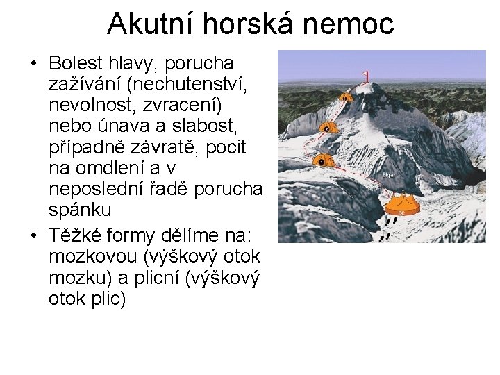 Akutní horská nemoc • Bolest hlavy, porucha zažívání (nechutenství, nevolnost, zvracení) nebo únava a