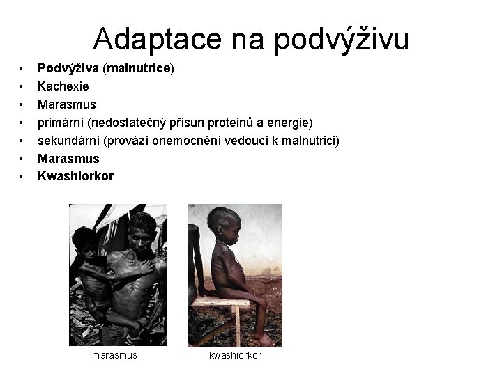 Adaptace na podvýživu • • Podvýživa (malnutrice) Kachexie Marasmus primární (nedostatečný přísun proteinů a