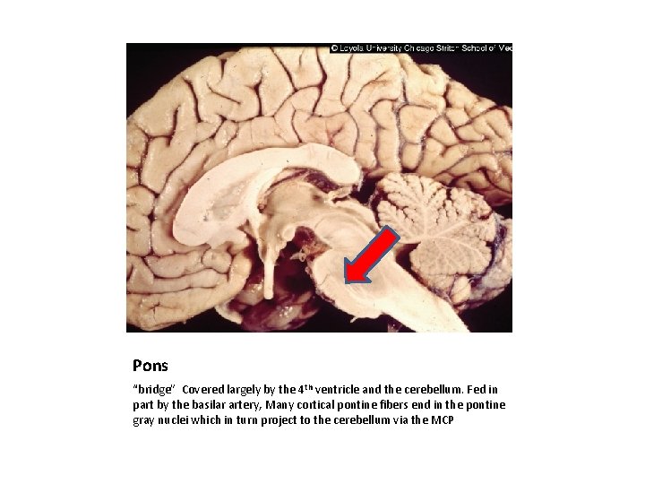 Pons “bridge” Covered largely by the 4 th ventricle and the cerebellum. Fed in