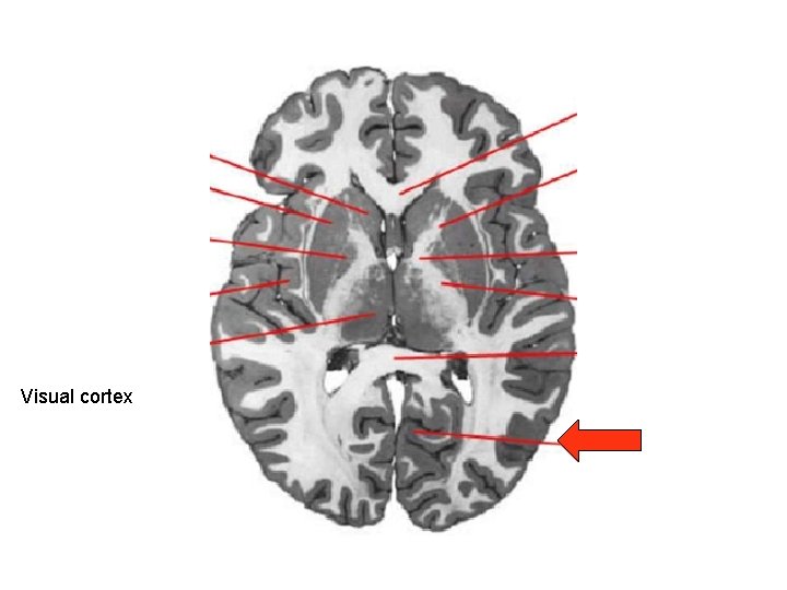 Visual cortex 