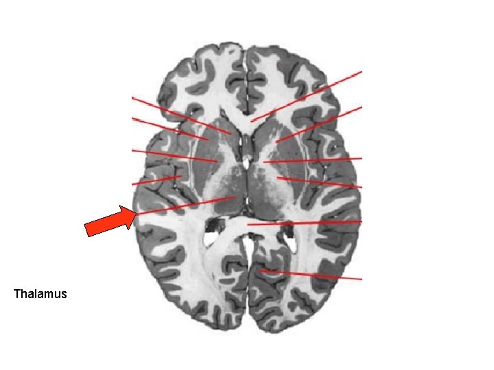 Thalamus 