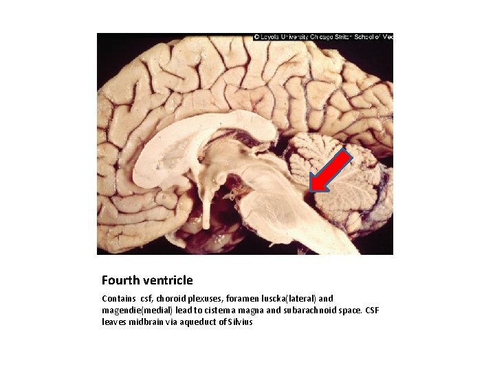 Fourth ventricle Contains csf, choroid plexuses, foramen luscka(lateral) and magendie(medial) lead to cisterna magna